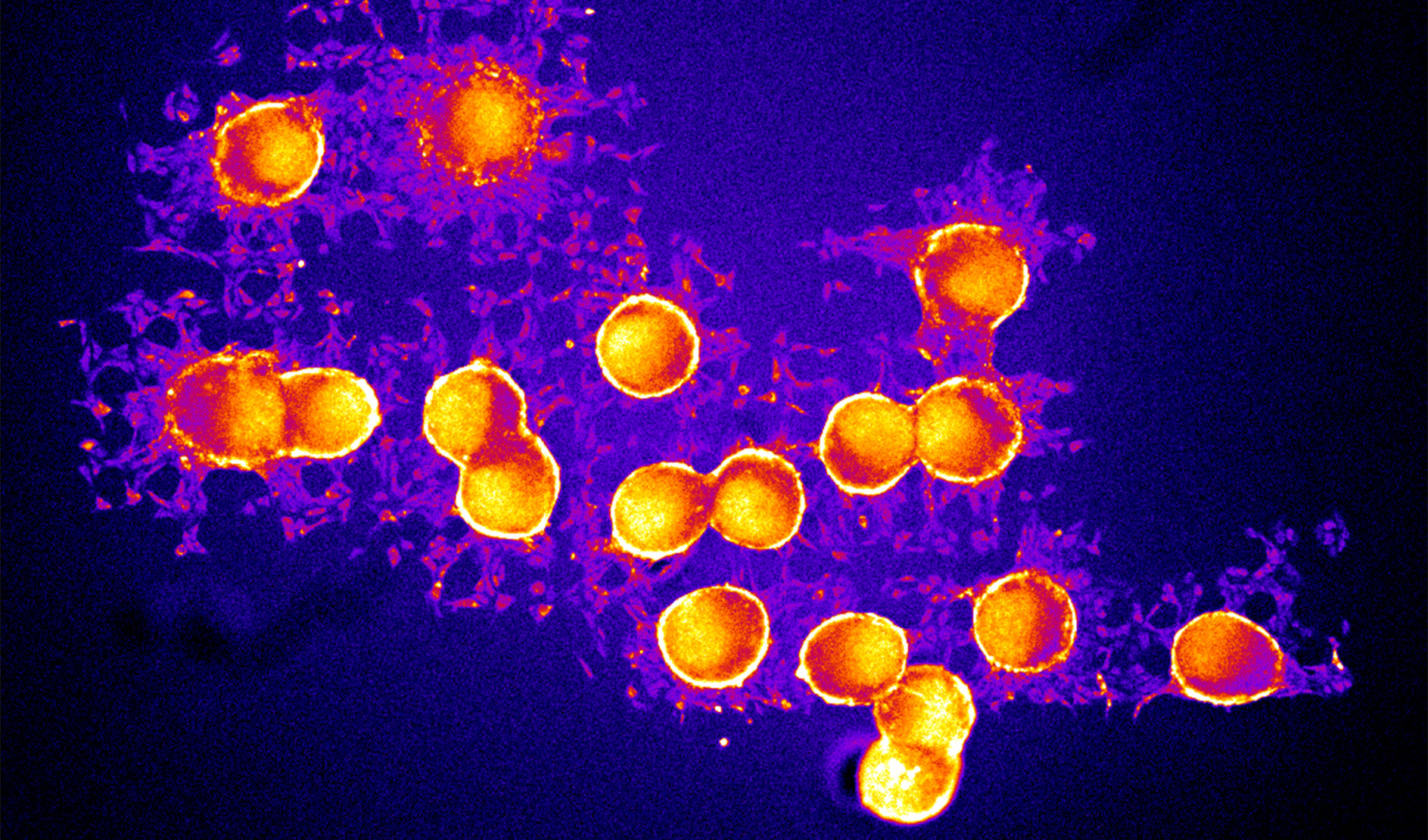 Imagining showing neuron spheroids on a chip designed to control the communication channels between the neuron cells