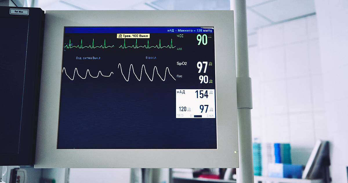 a close up of a heart monitor screen in a hospital