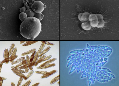 Labyrinthulids fungi | Sea Grant Scholars